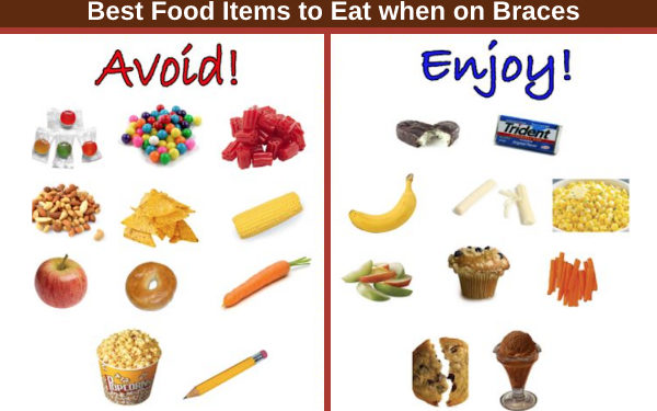 Foods You Can And Can t Eat With Braces Stavya Dental Clinic