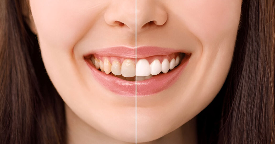 Aesthetic Dentistry