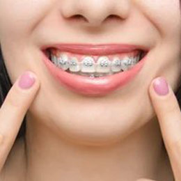Low Friction Braces