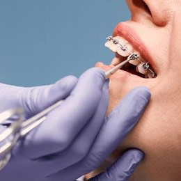 Orthodontics