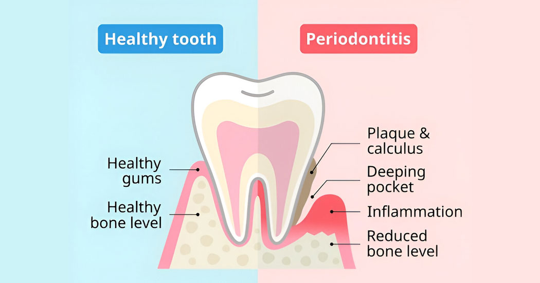 Periodontics