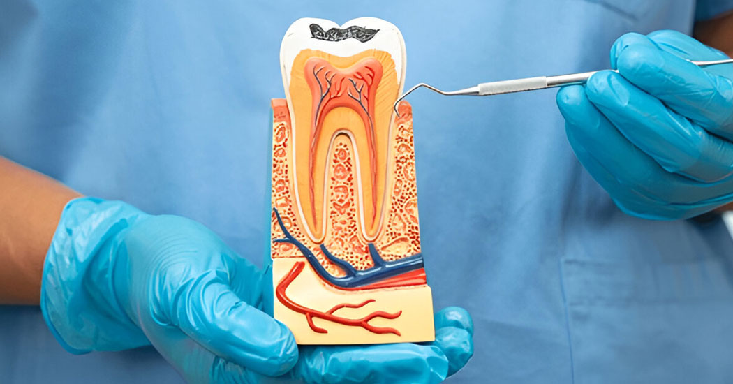 Root Canal Treatment (RCT) / Endodontics