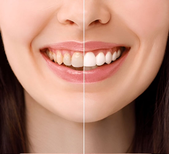 Aesthetic Dentistry