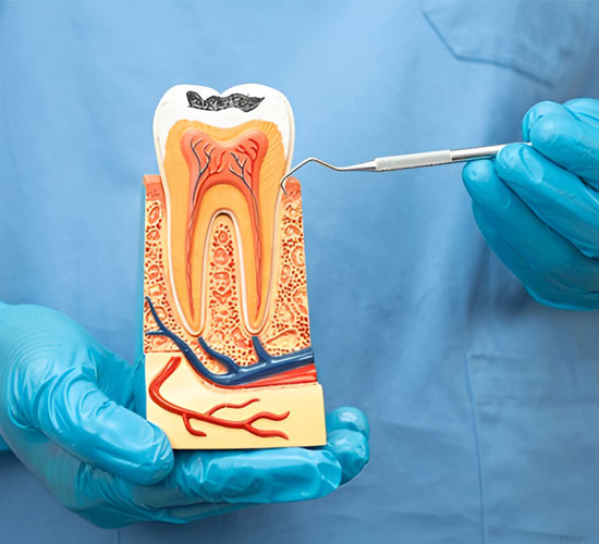 RCT Endodontics